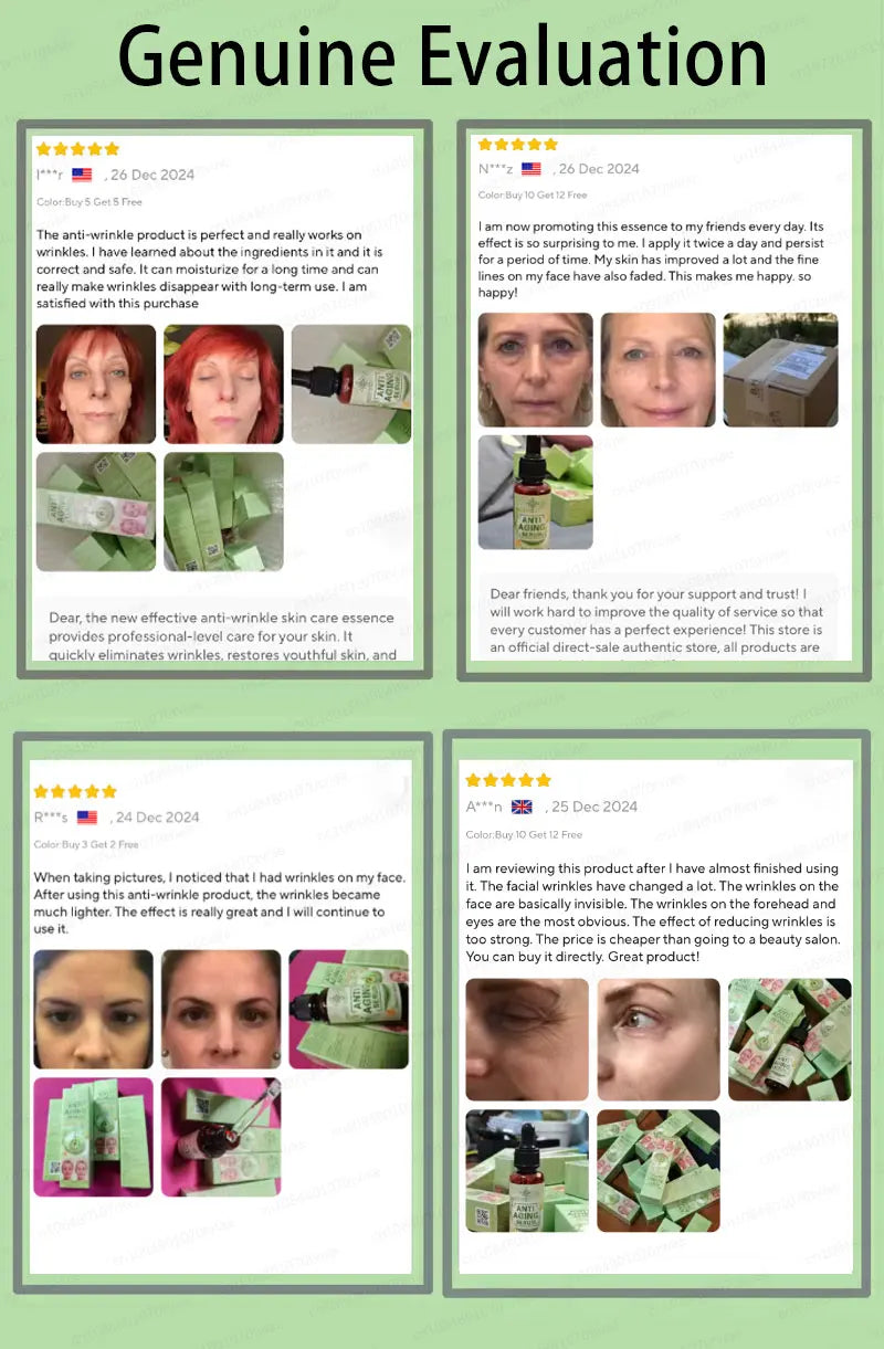 20 years younger, no fine lines