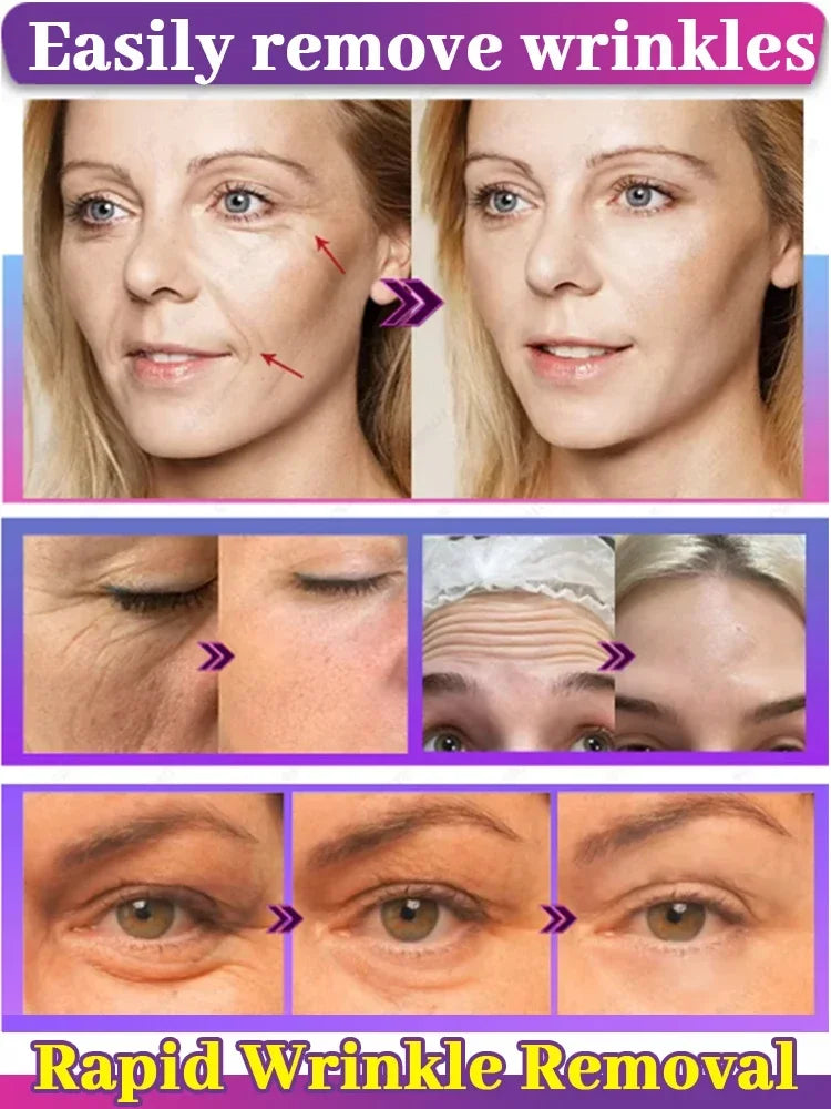 20 years younger, no fine lines