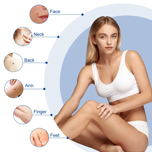 Auto Large Size Skin Tag Removal Kit For Large Skin Tags 4-9mm With Cleansing Swabs Home Use Face Skin Care Tool