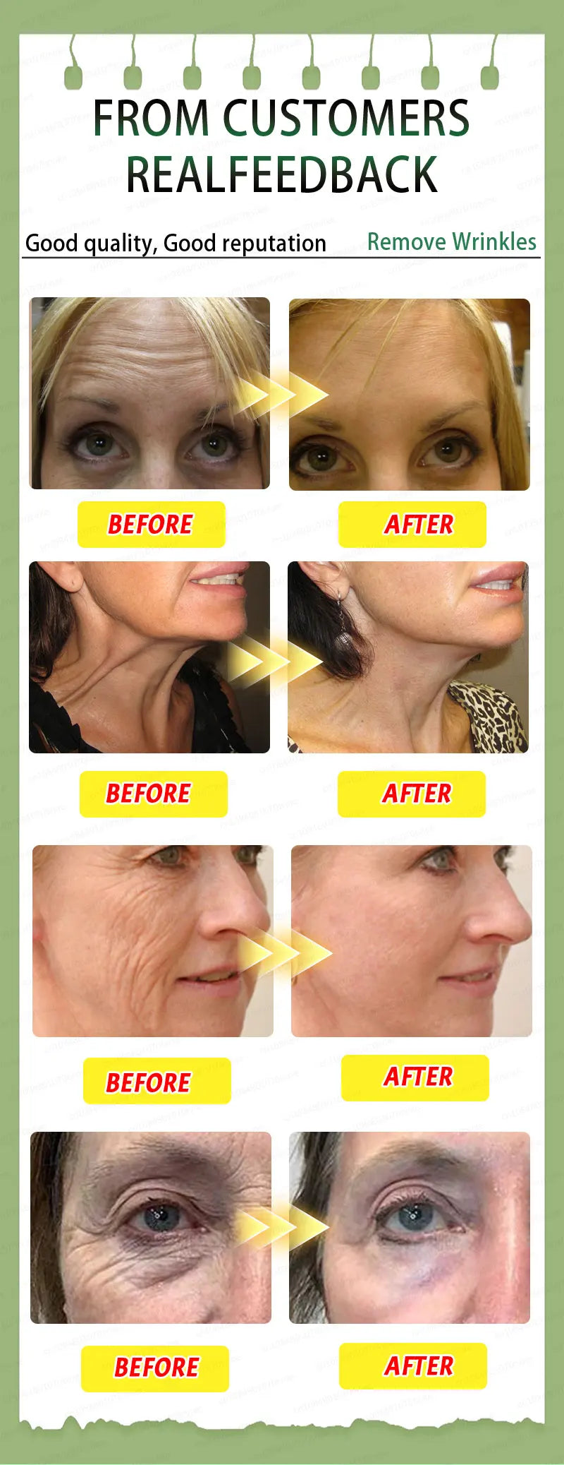 20 years younger, no fine lines